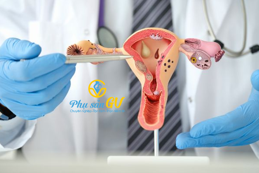 Thông vòi trứng bao lâu thì có thể thụ thai? Và cần lưu ý những gì sau khi thông vòi trứng?