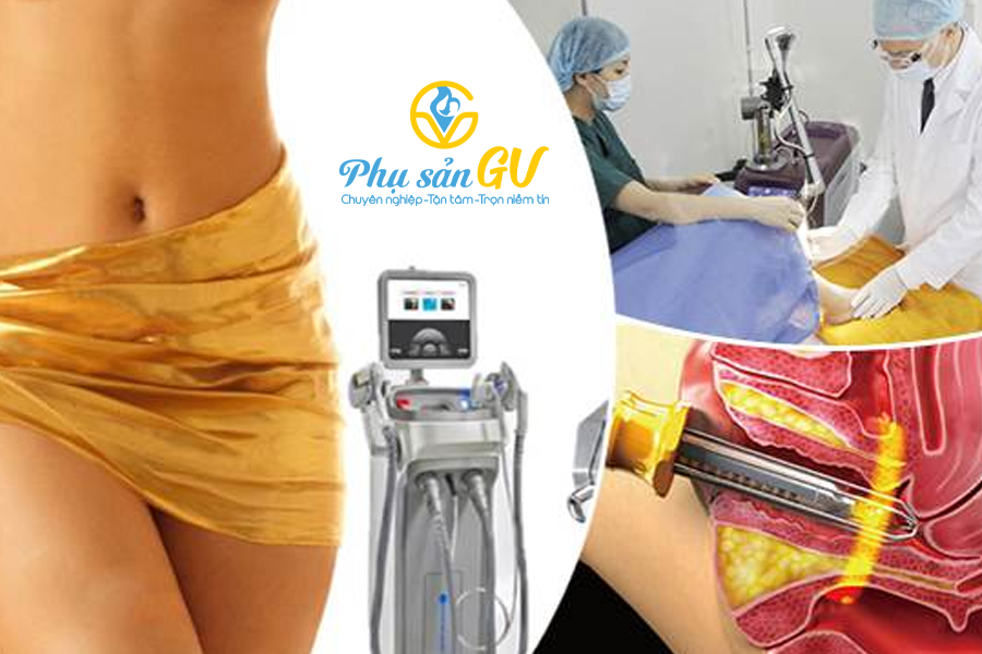 Trẻ hóa vùng kín bằng laser là gì? Cơ chế hoạt động và ưu điểm của phương pháp trẻ hóa âm đạo bằng laser